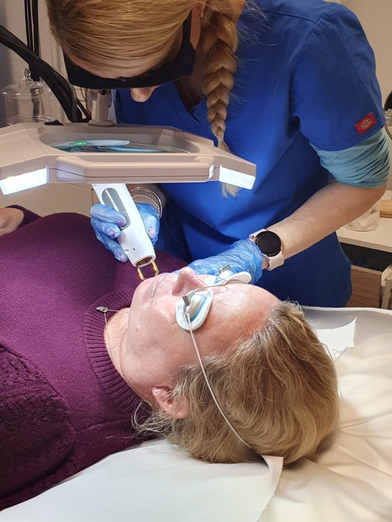 laser vein