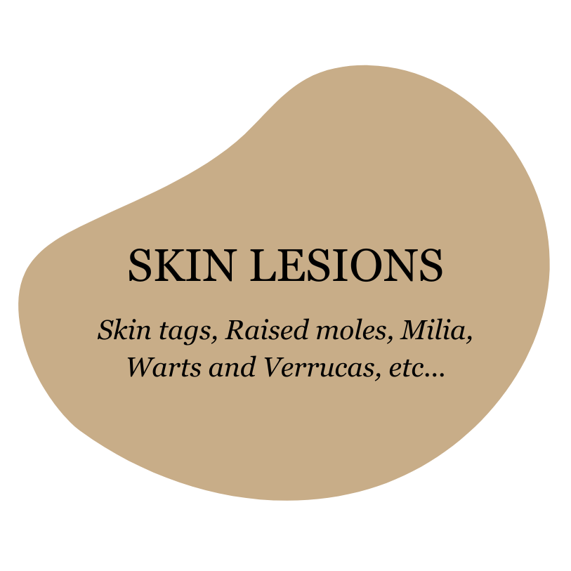 Skin Lesions