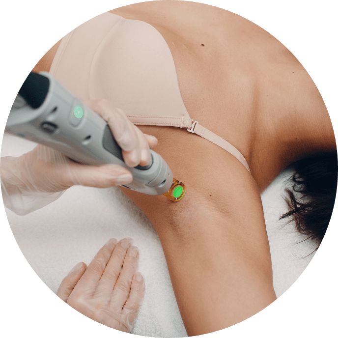 Hair removal
