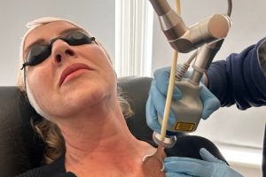 lines and wrinkles laser treatment