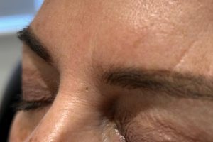 large pores