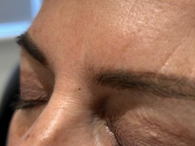 large pores large pores