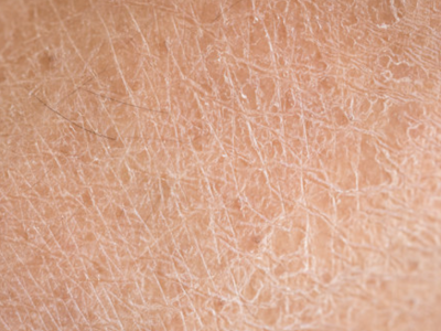 rough dry skin rough dry skin